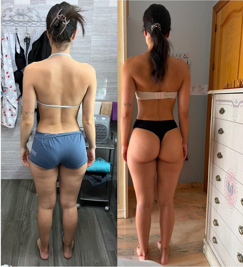 Transformación Ari - antes y después espalda