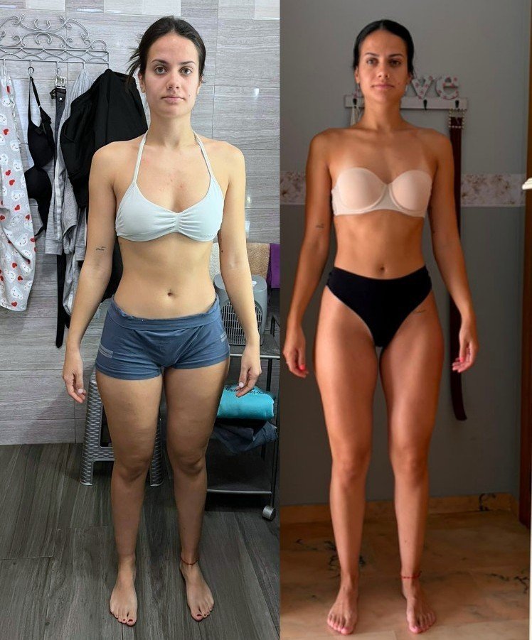 Transformación Ari - antes y después frente