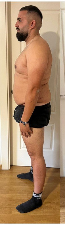 Transformación Ismael - antes