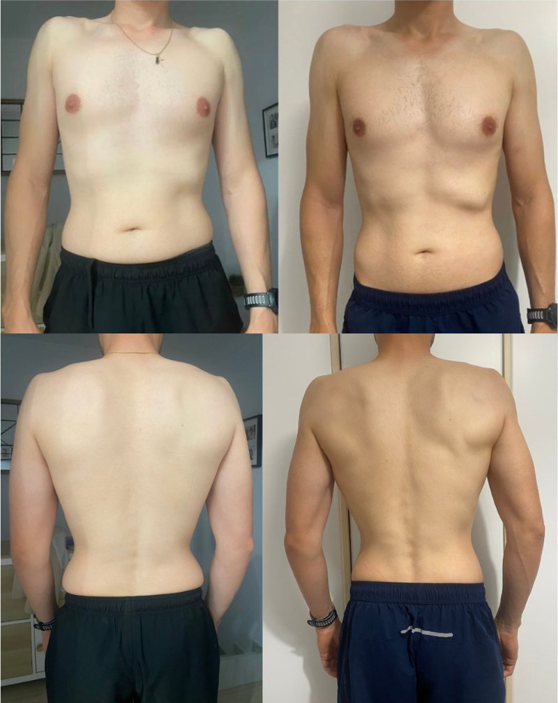 Transformación Alberto