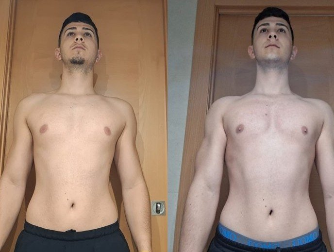Transformación Miguel - antes y después frente