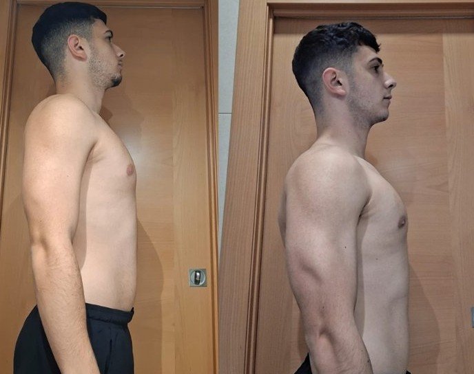 Transformación Miguel - antes y después perfil